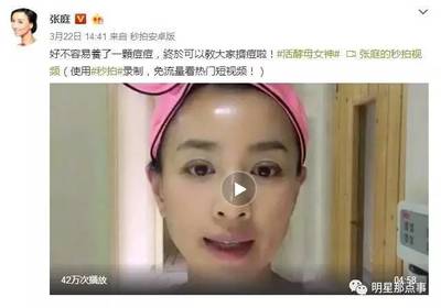 钟丽缇微博营销减肥产品 网友:下一个张庭!圈钱无底线!